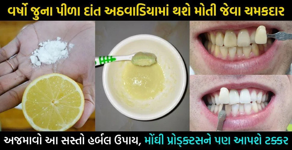 home-made-teeth-whitening-tips